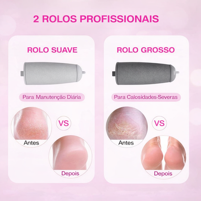 Removedor Elétrico de Calos para Pés – Pele Suave, Limpa e Renovada